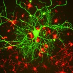 Growing human brain cells